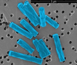 Метанобразующие бактерии Methanosaeta